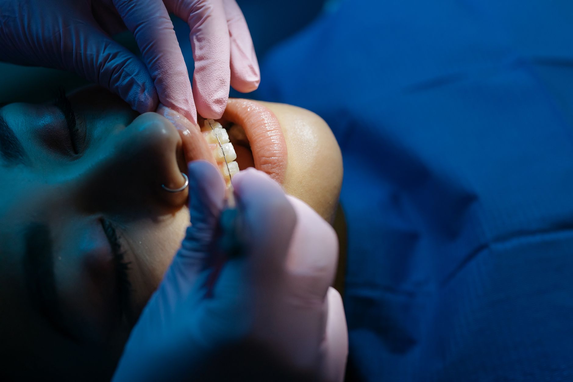 잇몸이 붓고 아플 때